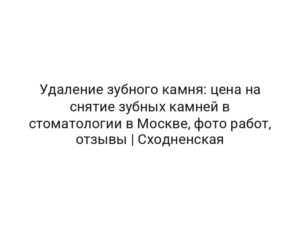 Удаление зубного камня: цена на снятие зубных камней в стоматологии в Москве, фото работ, отзывы | Сходненская